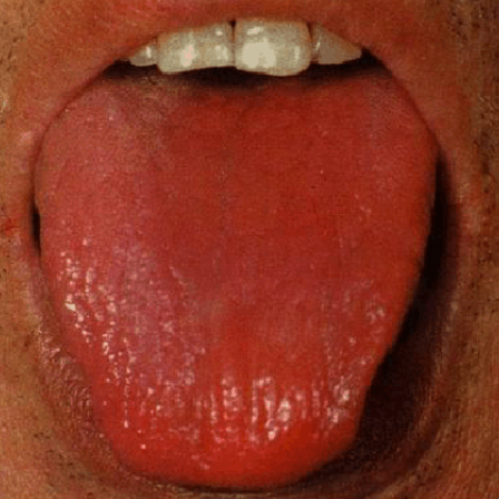 大学本科 医学 中医学类 问题详情对于红舌,可以根据舌苔的有无来判断